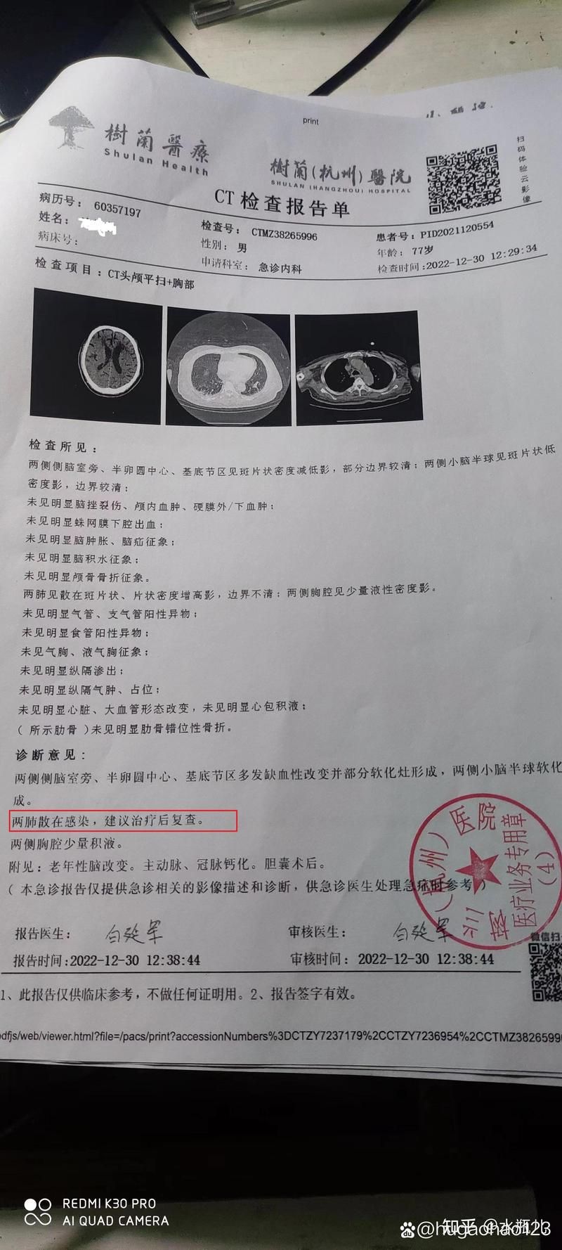 专家:永春县每年或现多个感染高峰/永春县新型肺炎确诊病例