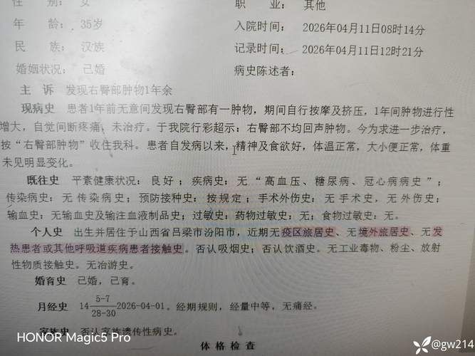 【阿里地区现有核酸阳性28例,阿里河最新确诊病例】