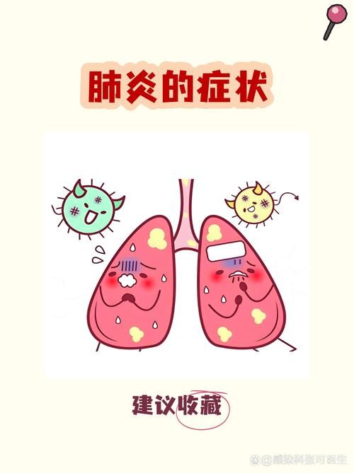 预计近2天广西壮族自治区柳州市柳南区二次疫情爆发/柳州市新型冠状病毒感染的肺炎疫情