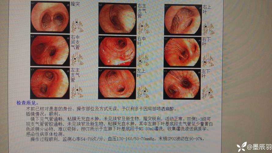 全球新增阳性感染者13例龙港16例_全球新增病例情况